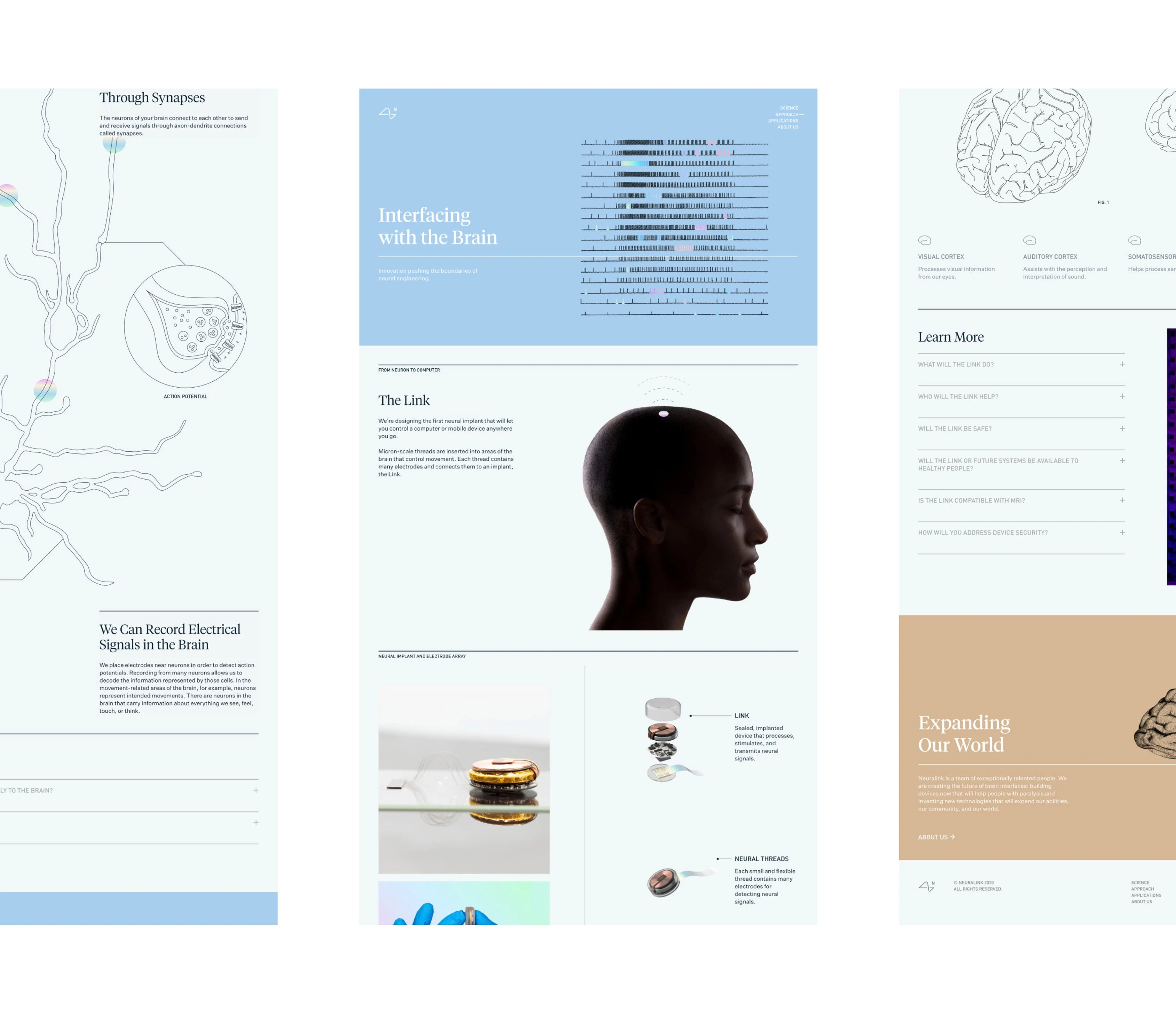 Neuralink